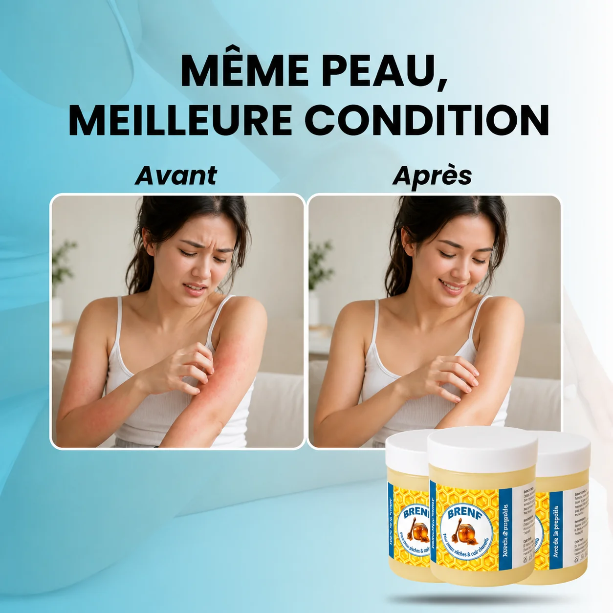 GlacierSkin – BRENF Baume Réparateur contre l’Eczéma et le Psoriasis