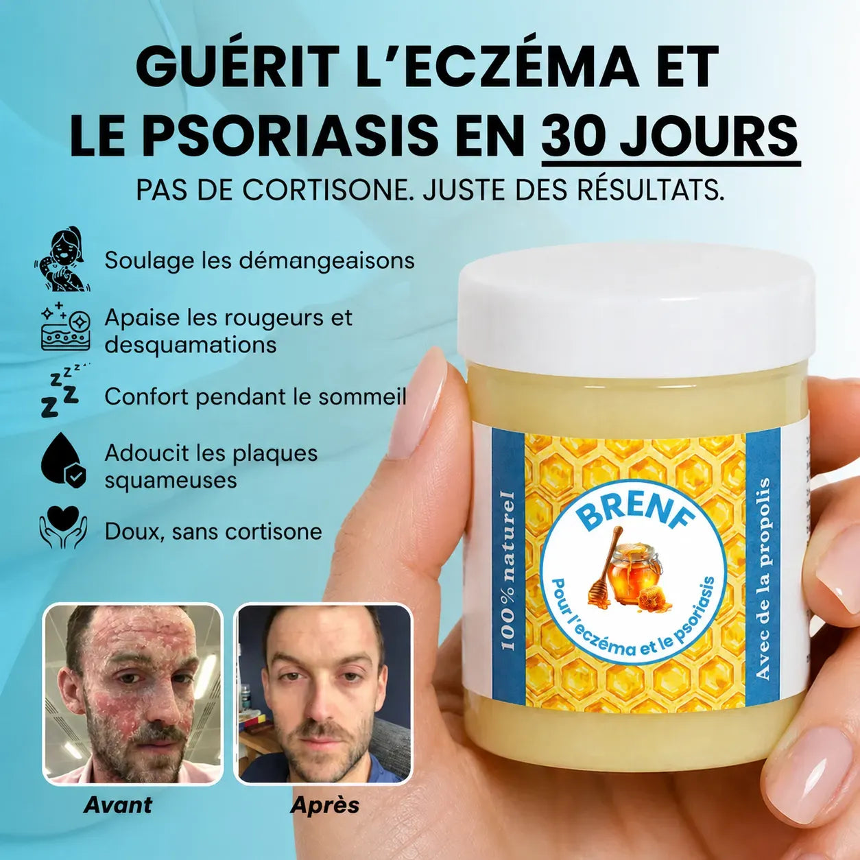 GlacierSkin – BRENF Baume Réparateur contre l’Eczéma et le Psoriasis