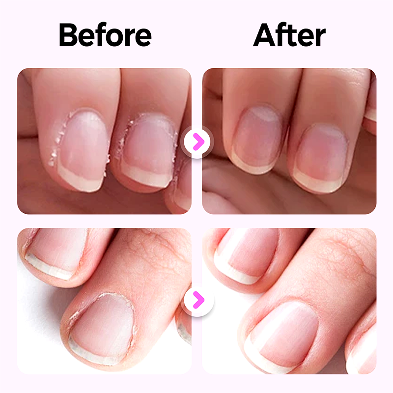 Sérum fortifiant en stylo pour les ongles – formule nourrissante qui prévient les cassures et nourrit le lit de l’ongle